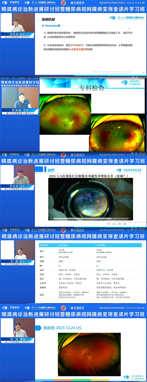 眼底診治新進展研討班